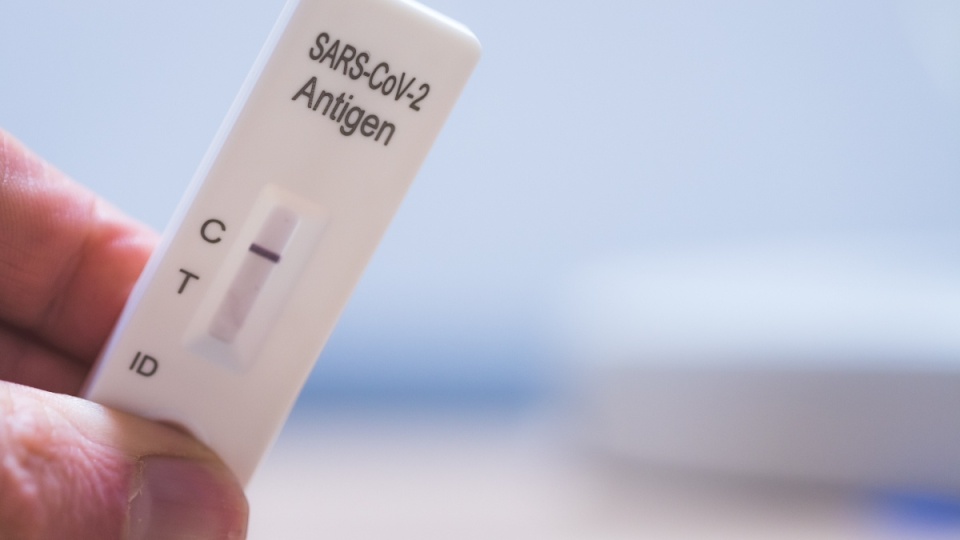 Rapid antigen tests