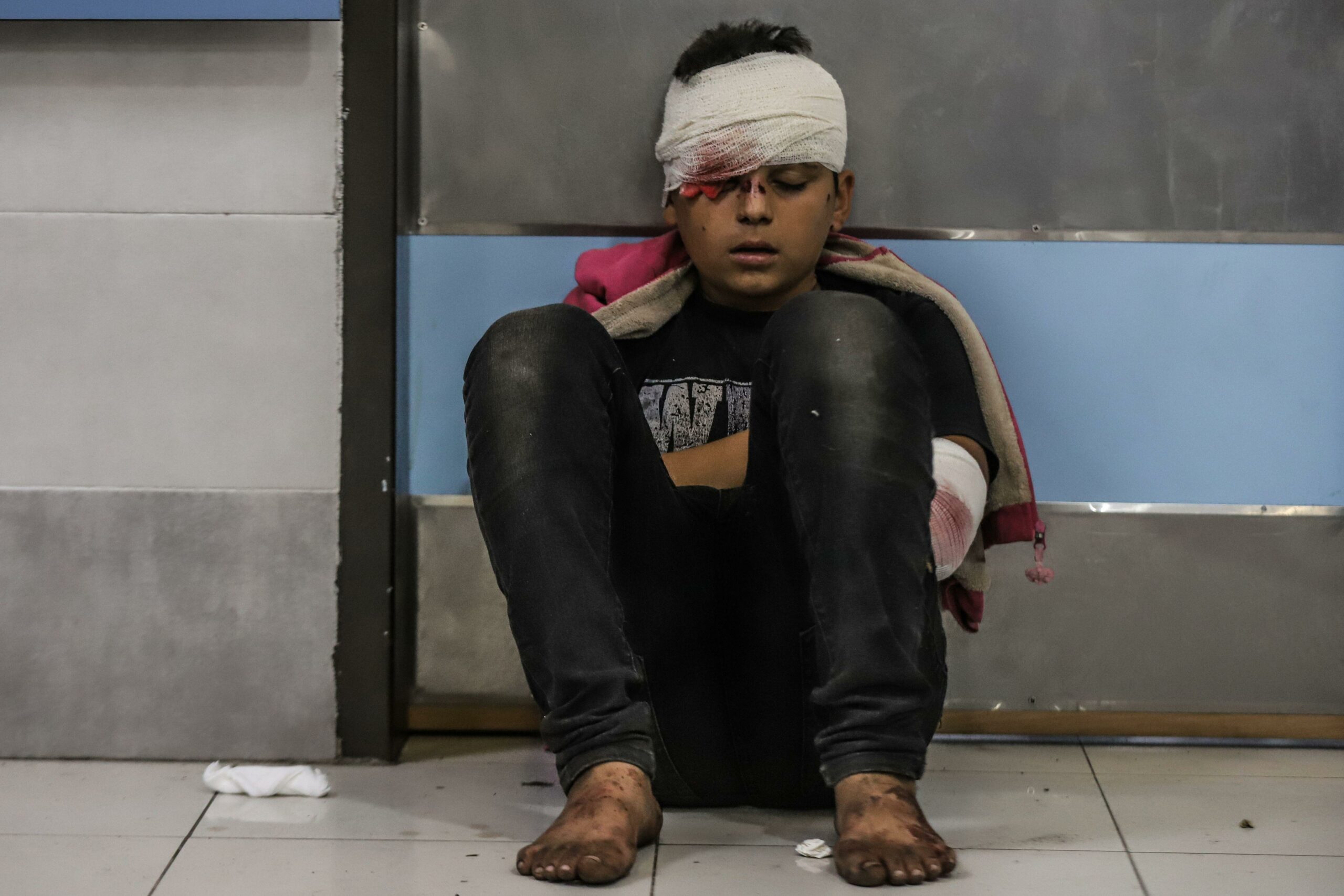 Gaza City, Palestinian Territories. 17th Oct, 2023. A Palestinian child injured in an Israeli shelling on the Ahli Arab hospital, sits at al-Shifa hospital in Gaza City. According to the Gaza Health Ministry, hundreds of people were killed and injured in an Israeli airstrike on Ahli Arab hospital that houses thousands of refugees. Image: Mohammad Abu Elsebah/dpa/Alamy Live News