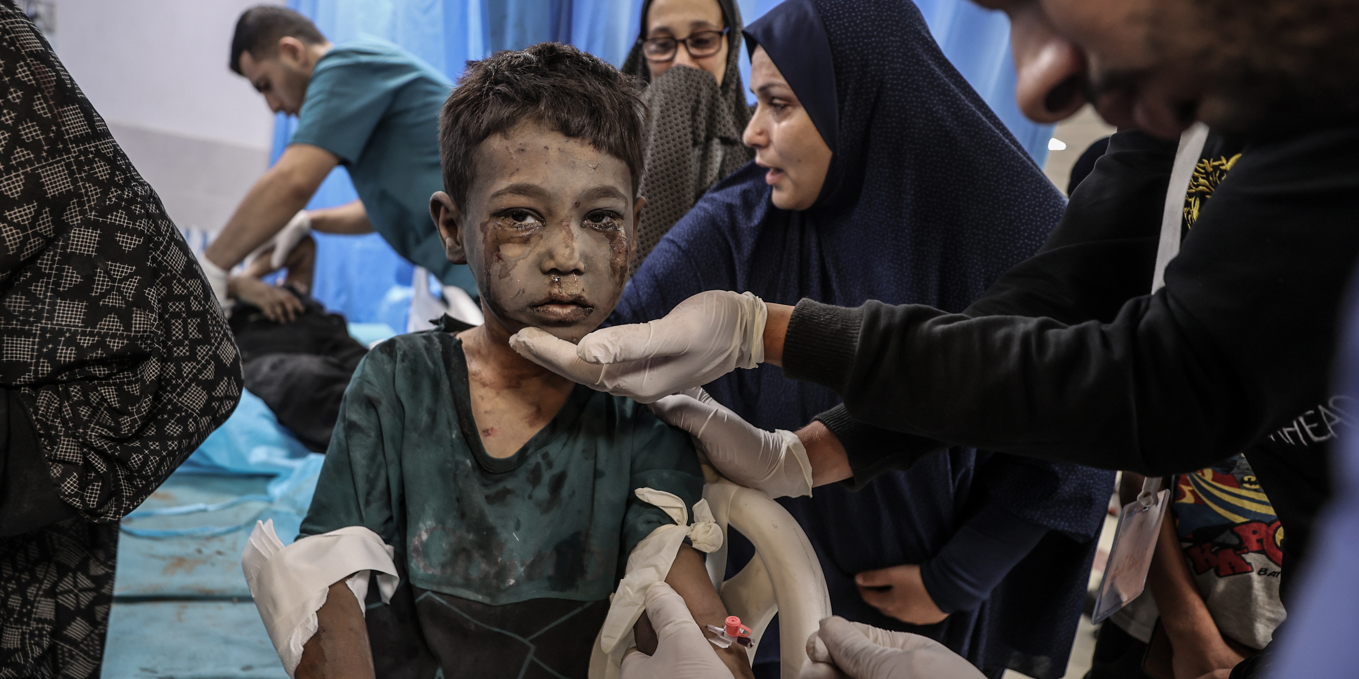 Doctors examine an injured child at Al-Shifa Hospital after an Israeli attacks on Gaza City, Gaza on October 21, 2023.