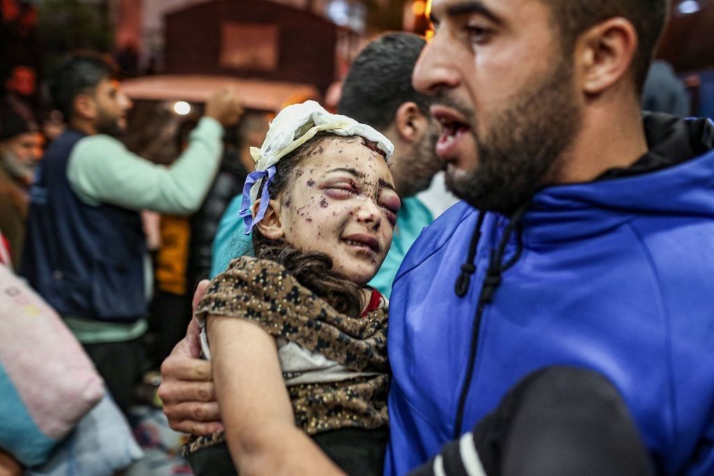 A man holds an injured child in a Gaza hospital. 