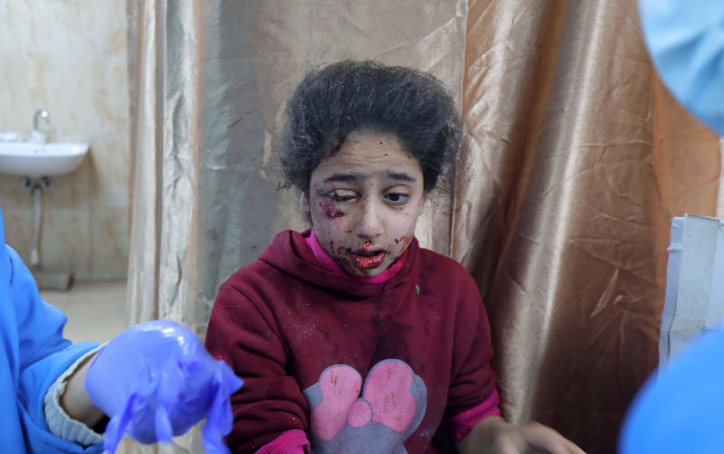 Injured Palestinian people, including children are taken to the Al-Aqsa Martyrs Hospital for a treatment as Israeli attacks continue in Deir al-Balah Injured Palestinian people, including children are taken to the Al-Aqsa Martyrs Hospital for a treatment as Israeli attacks continue in Deir al-Balah, Gaza on December 28, 2023. Photo by Omar Ashtawy apaimages Dair El-Balah Gaza Strip Palestinian Territory 281223_Dair_El-Balah_OSH_1_004 Image:xapaimagesxOmarxAshtawyxxapaimagesx/Alamy