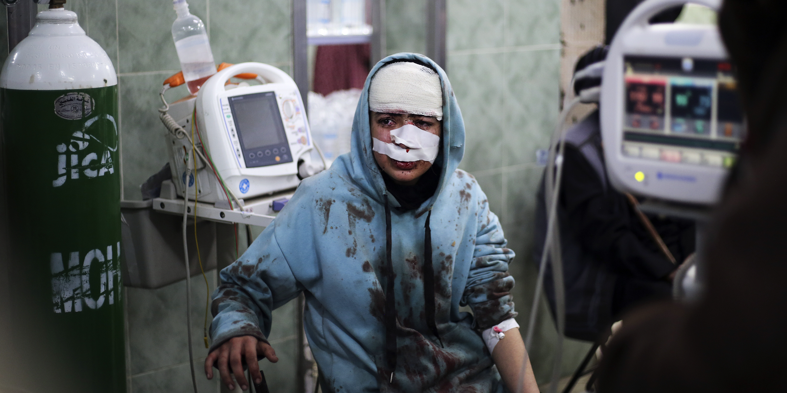 A Palestinian wounded in the Israeli bombardment sits in a hospital In Rafah, Gaza Strip, Saturday, Feb. 10, 2024. (AP Photo/Hatem Ali)