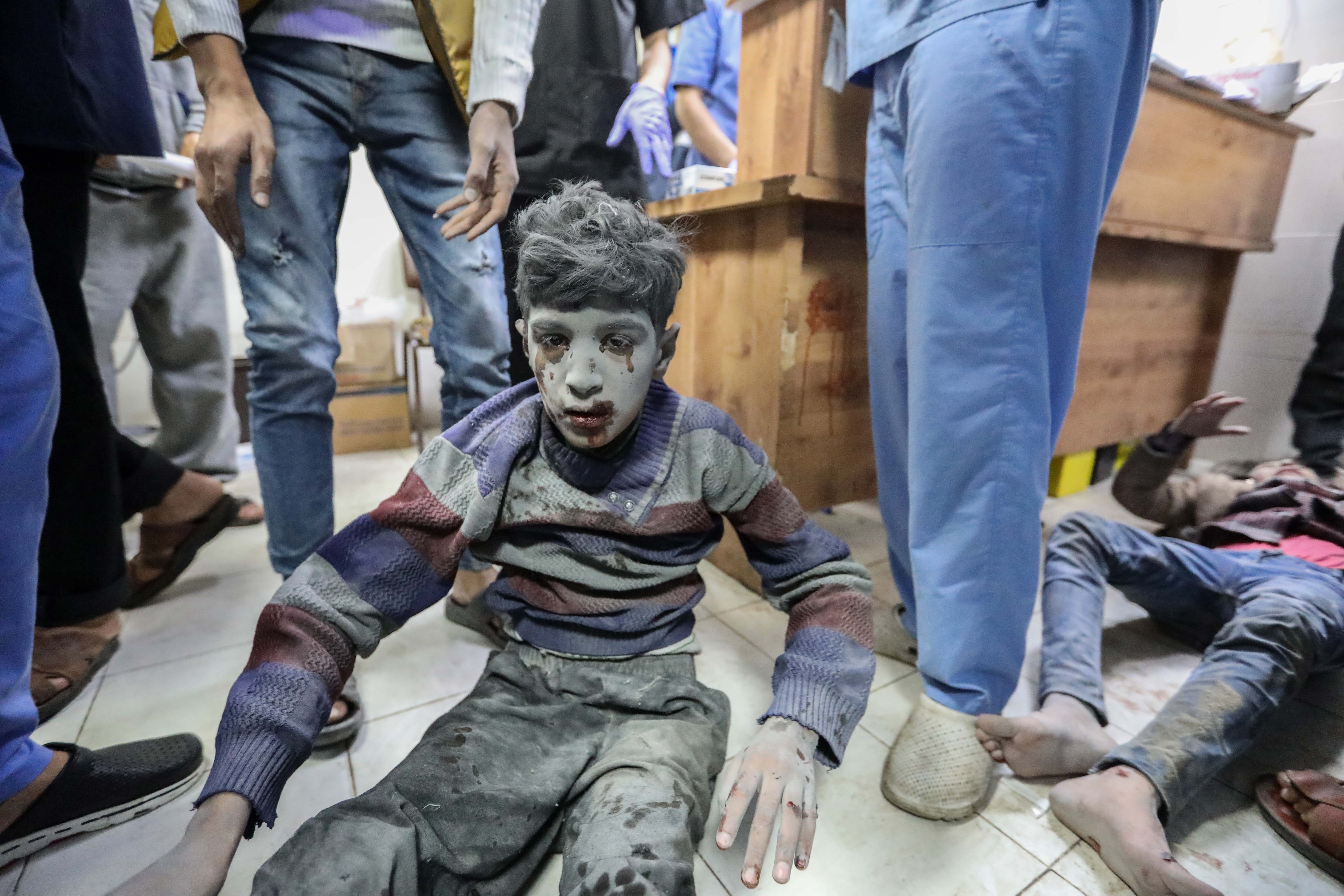 Injured Palestinian child